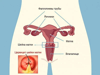 Картинка 3 Картинка 3