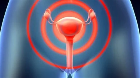 Что такое лейкоплакия вульвы и какое лечение необходимо?