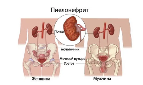 Картинка 3