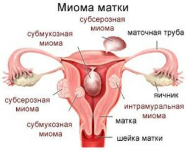 Иллюстрация 1 Иллюстрация 1