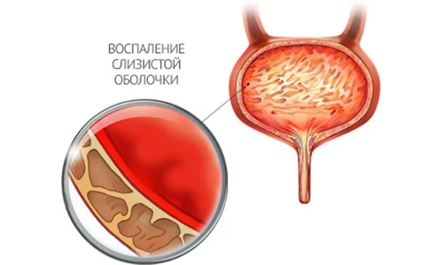 Иллюстрация 2