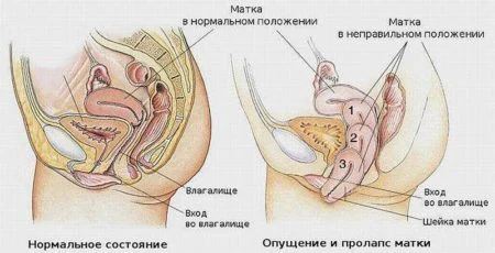Иллюстрация 3 Иллюстрация 3