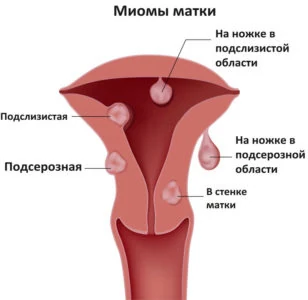Изображение 6 Изображение 6
