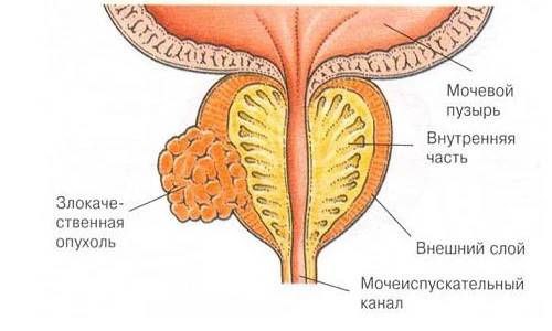 Изображение 2 Изображение 2