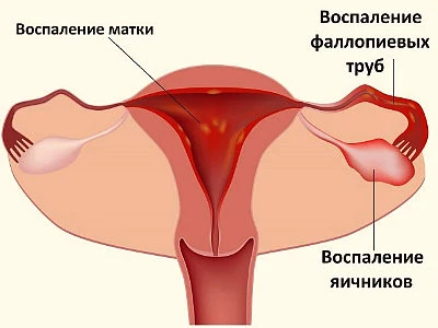 Картинка 1 Картинка 1