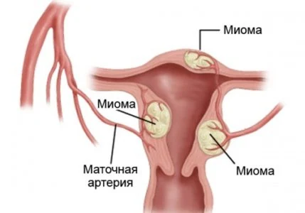 Изображение 4 Изображение 4