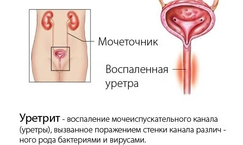 Изображение 4 Изображение 4
