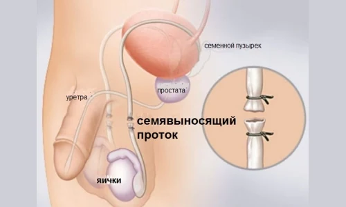 Картинка 3 Картинка 3