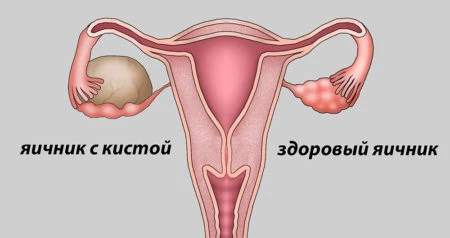 Картинка 1 Картинка 1