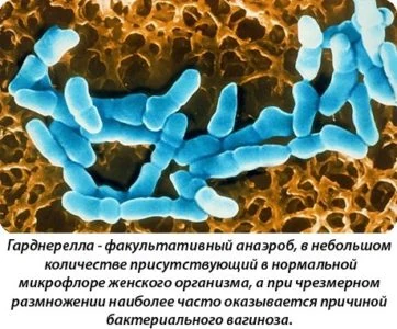 Картинка 3