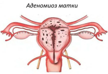 Картинка 2 Картинка 2