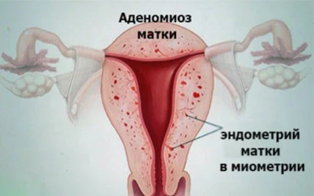 Иллюстрация 3