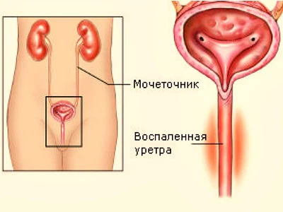 Картинка 1 Картинка 1