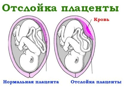 Изображение 5 Изображение 5