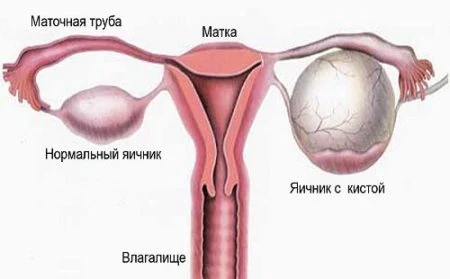 Изображение 1 Изображение 1