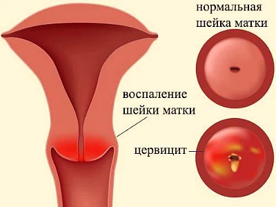 Иллюстрация 1 Иллюстрация 1