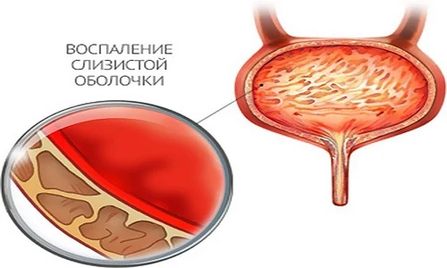 Картинка 1 Картинка 1