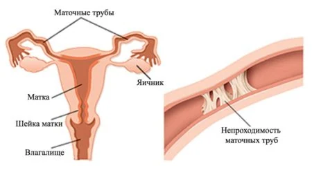 Картинка 1 Картинка 1