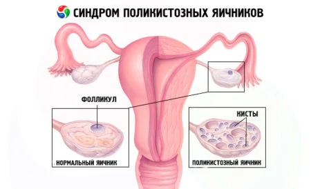 Иллюстрация 2