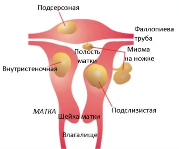 Изображение 4 Изображение 4