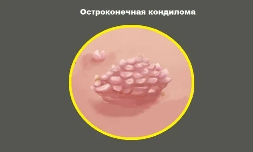 Картинка 3 Картинка 3