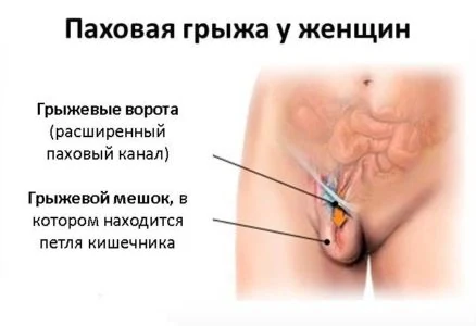 Картинка 2
