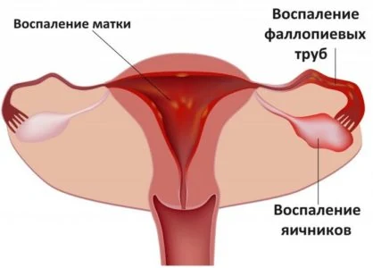 Иллюстрация 3 Иллюстрация 3