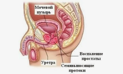 Картинка 2 Картинка 2